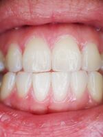 teeth-887338 1920.jpg